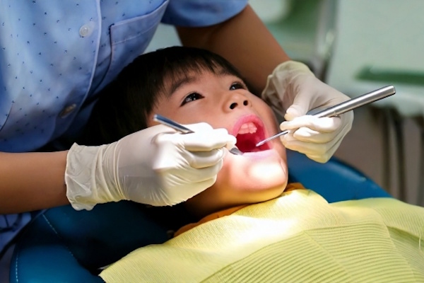 小児歯科