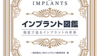 インプラント図鑑: 視覚で巡るインプラントの世界」（安倍 稔隆